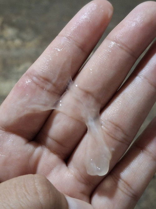 อีก2วันถึงกำหนดปจดจะมา แต่วันนี้รู้สึกปวดท้องน้อยเล็กน้อยแต่ดันเจอแบบนี้เรียกว่าอะไรค่ะ