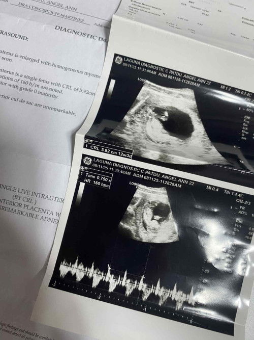 Ano po kaya ang possible gender ni baby?