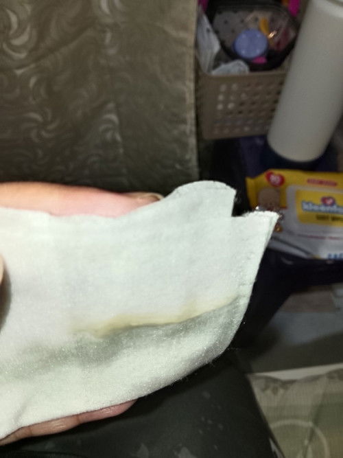 Mucus plug out