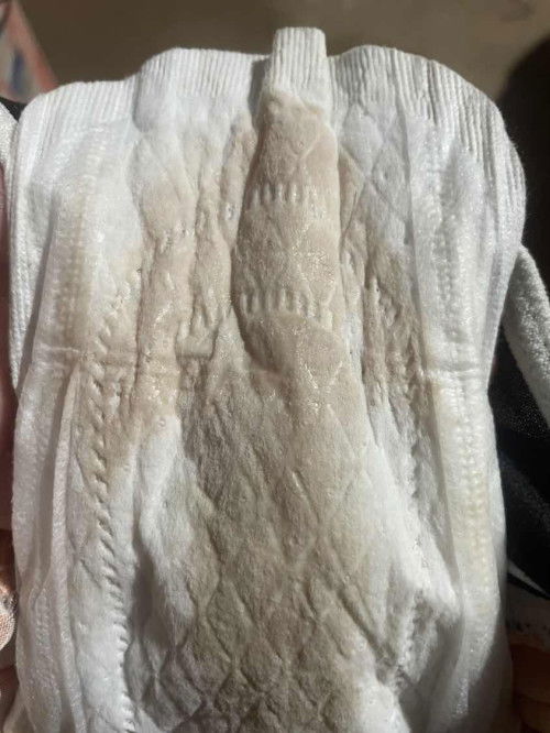 แบบนี้เรียกว่าน้ำคร่ำไหมค่ะ