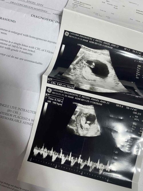 GIRL OR BOY ?