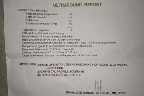 Ultrasound