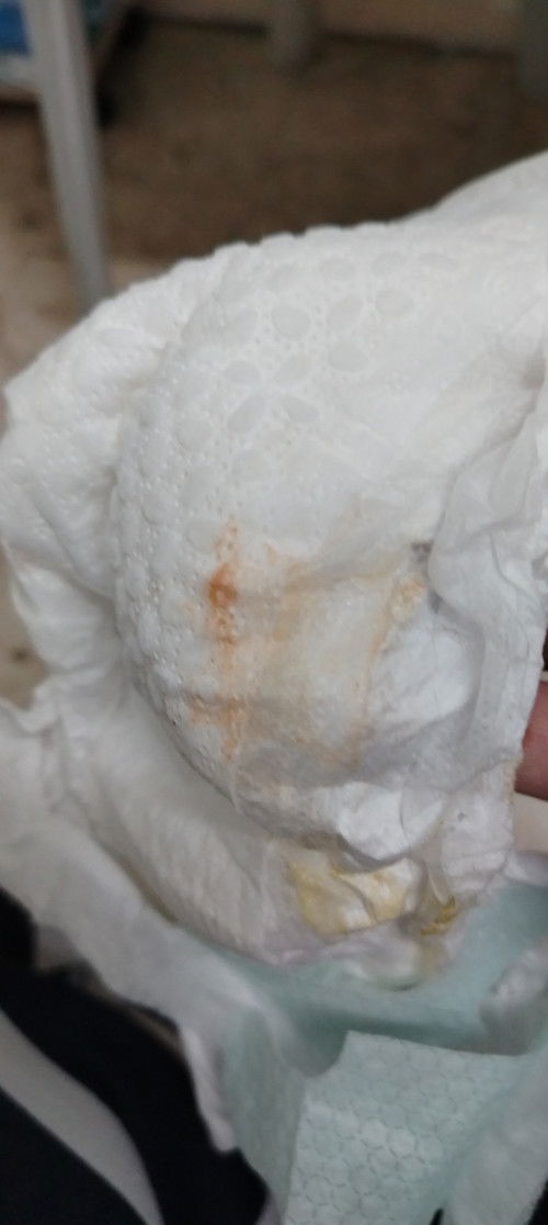 Newborn Urine