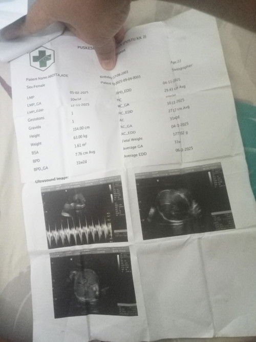Berat bayi