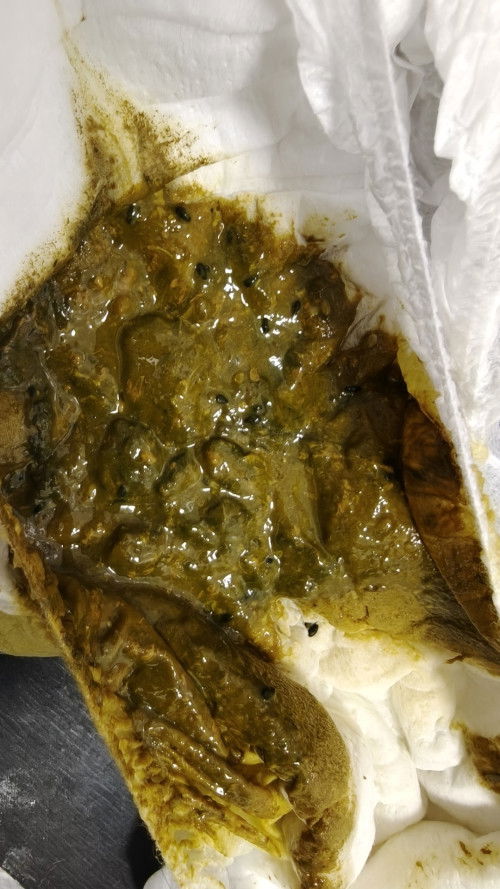 1ขวบเริ่มนมกล่อง แต่ก็ยังกินนมแม่ อยากรู้ว่าถ่ายแบบในรูปปกติมั้ย