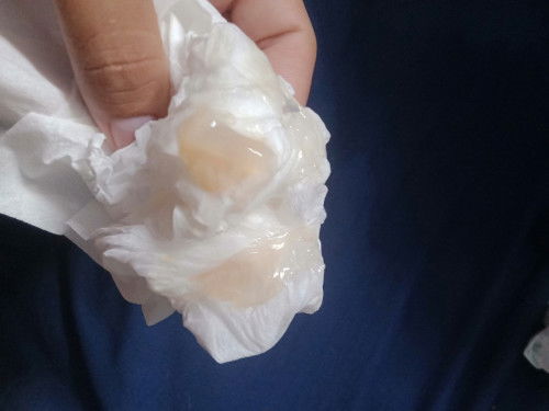 แบบนี้น้องใกล้ออกรึยังคะแม่  37+3