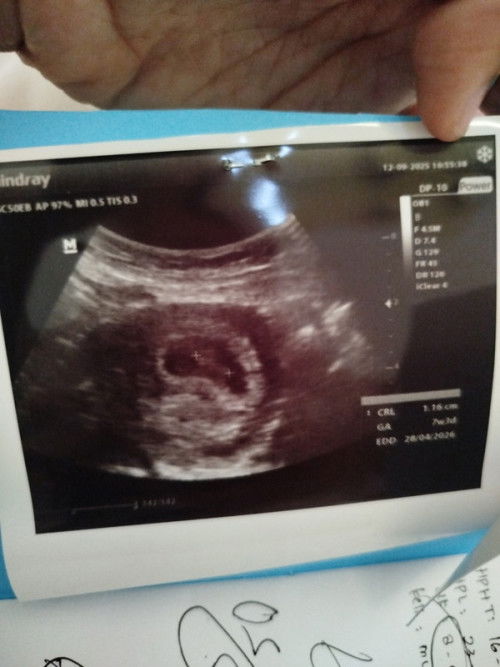 Harusnya usia 8week di usg 7w3d