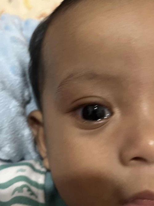 mata bayi keluar air mata