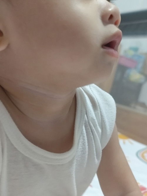 Is it normal? 🥺
