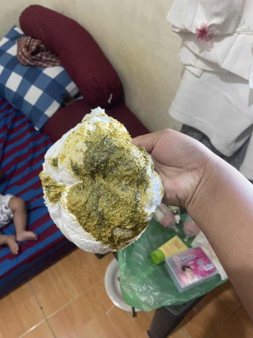 Tekstur bayi 4 bulan seperti ini apakah normal