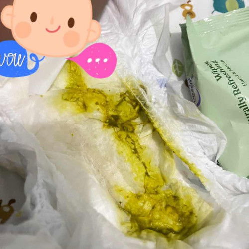 Bab bayi 2 bulan dan full asi