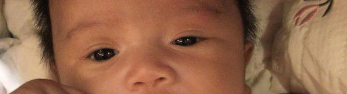 Mata bayi kecil sebelah