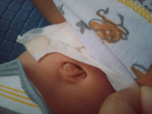 Bun mau tanya, seputar pusar bayi