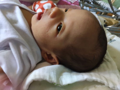 hello po. FTM po. ask q lang po if normal shape po ang head ng baby q. c-s po kc aq.