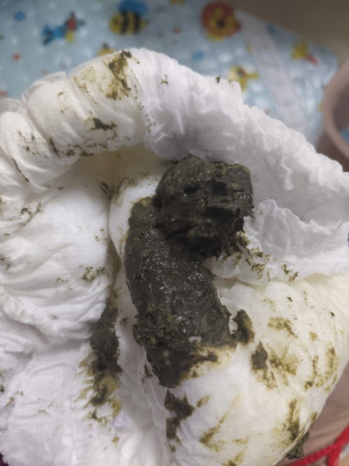 อึน้องเป็นสี