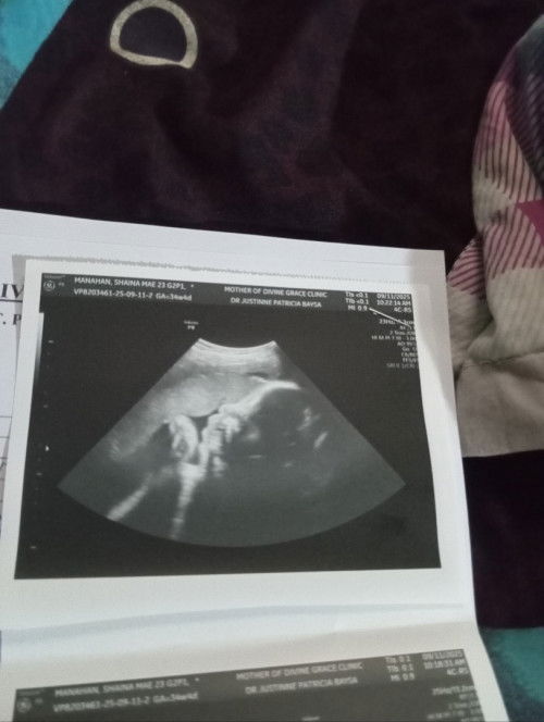 It's a girl