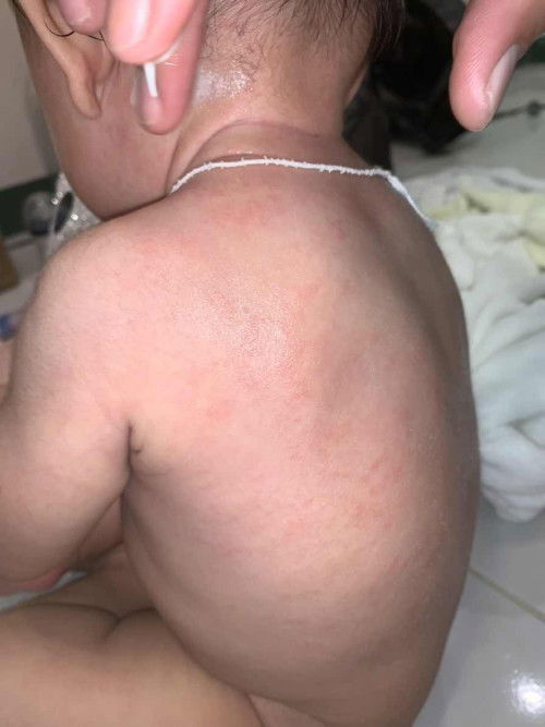 ขอสอบถามแม่ๆหน่อยนะคะ