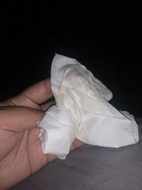 38วีค อยากสอบถามแม่ๆค่ะ