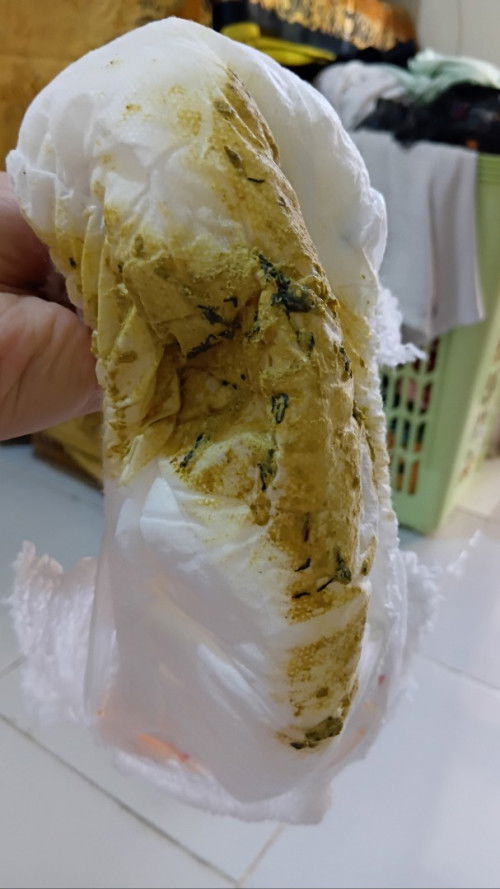 Bun ini cacingan ga si 😭