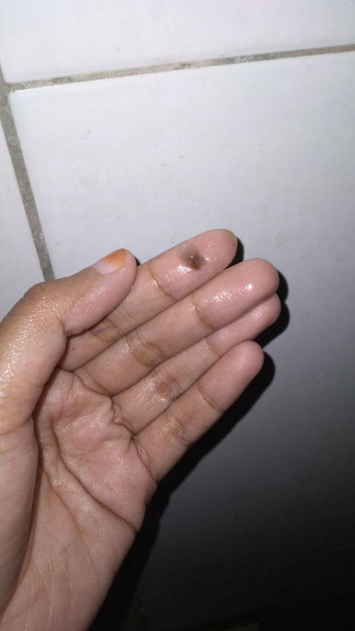 Flek sebelum tanggal haid