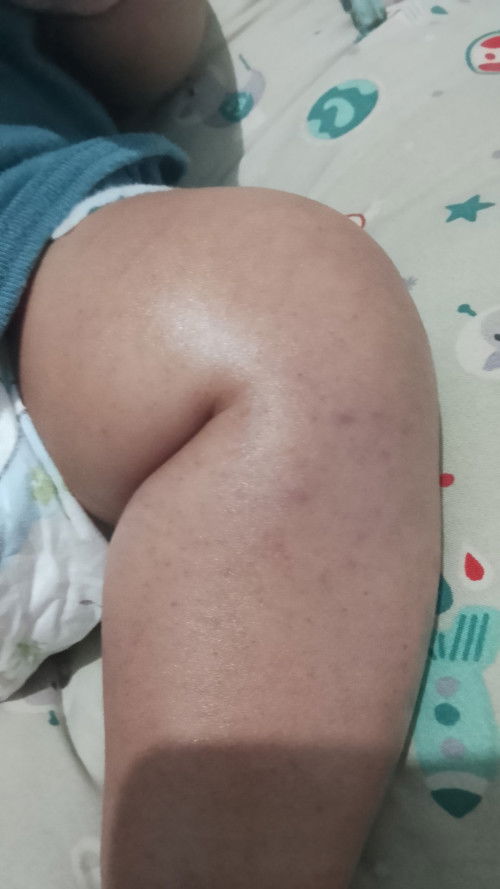 Bintik merah di kaki