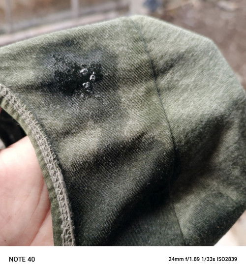 Ketuban rembes atau bukan