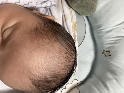 Kepala bayi 2 minggun nampak berurat ? Ada yg ngalaminnya ?tolong coment