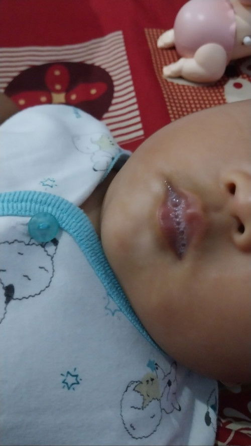 Putih2 sekitar bibir