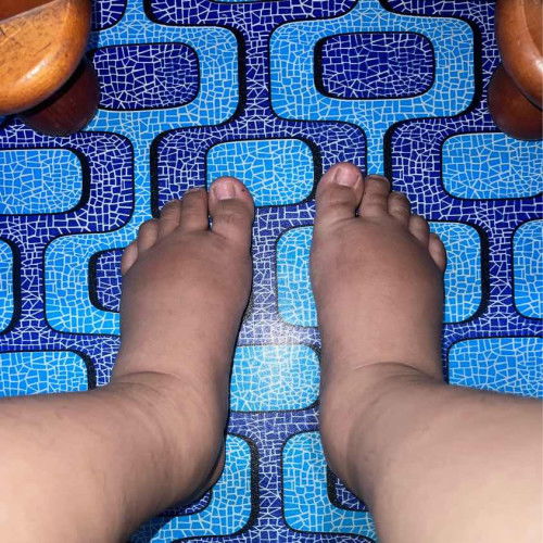 Normal ka ini?