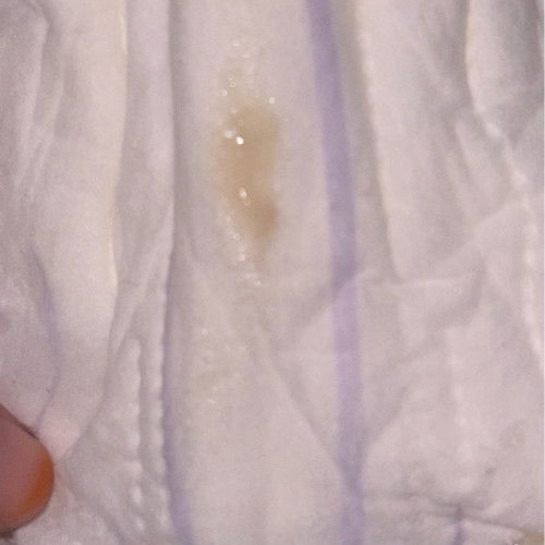 Mucus plug?