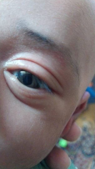 Warna mata baby
