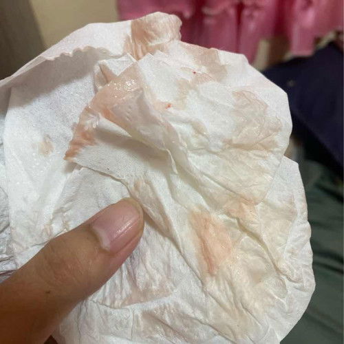 มีอาการตกขาวชมพูอ่อนๆ 24 w