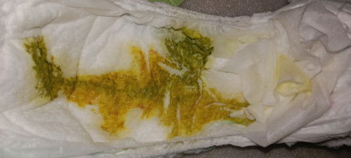 Pup anak kyk gini apakah normal bun?