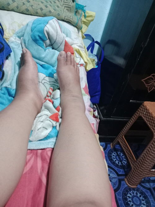Kaki bengkak