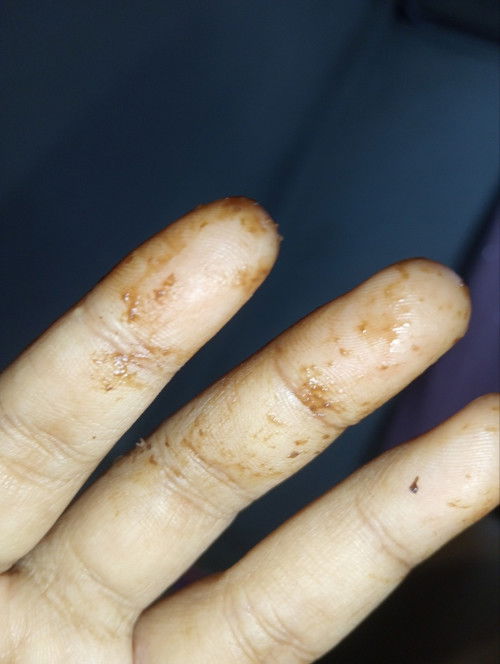 อยากสอบถามค่ะกังวลมาก