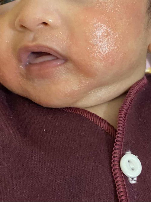 kulit muka bayi kuuu