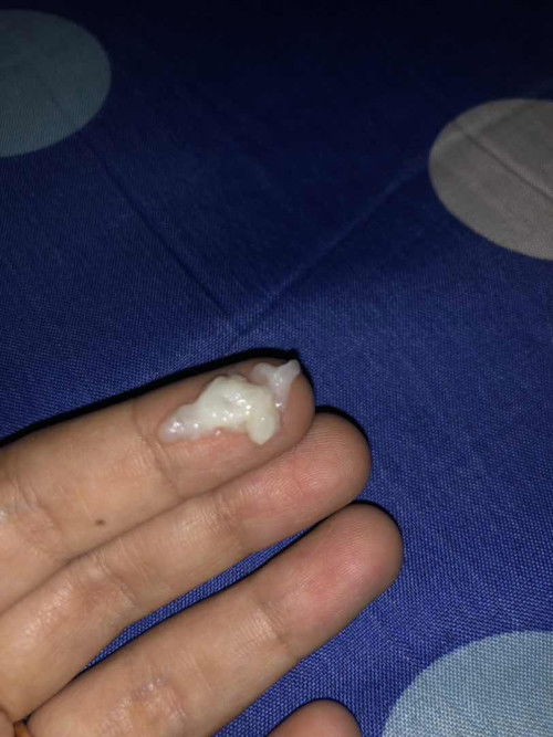 Keputihan seperti ini normal tidak ya