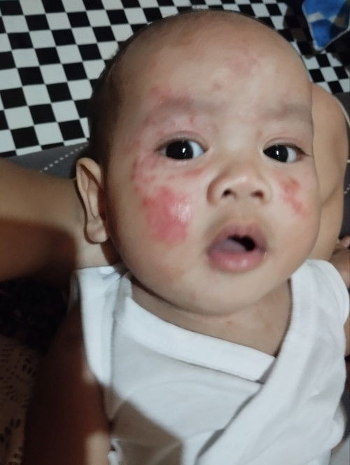 Mga mommy pa help na mn po first time mom po kasi ako.Ano po bang mabisang gamot sa ganyan ni baby?