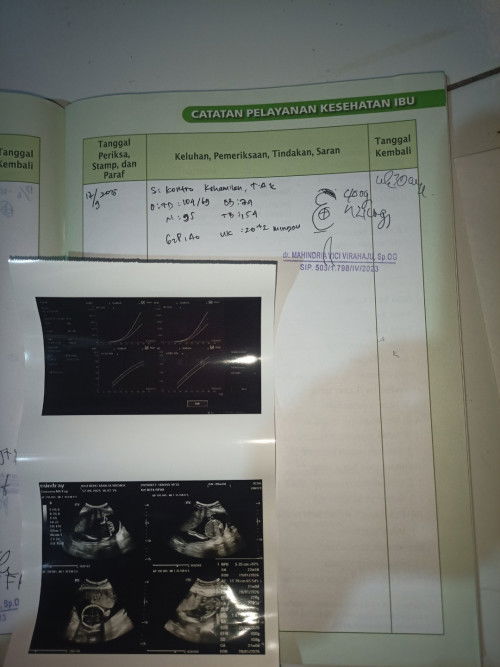 Bun... Adakah disini yg bisa baca hasil usg ???... 
Saya kemarin usg minggu ke 20+2 hasilnya cewek..