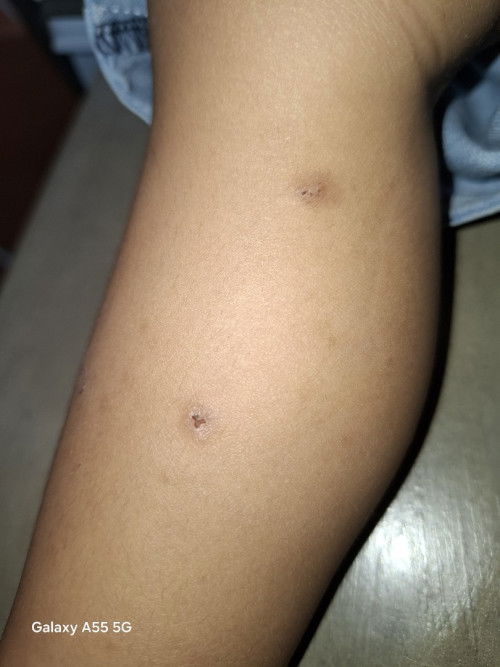 Krim/Lotion Penghilang Hitam-Hitam