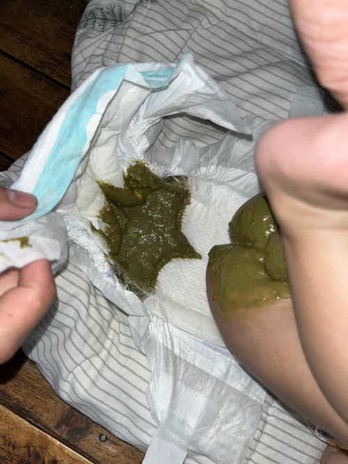 Feses bayi 2 bulan warna hijau