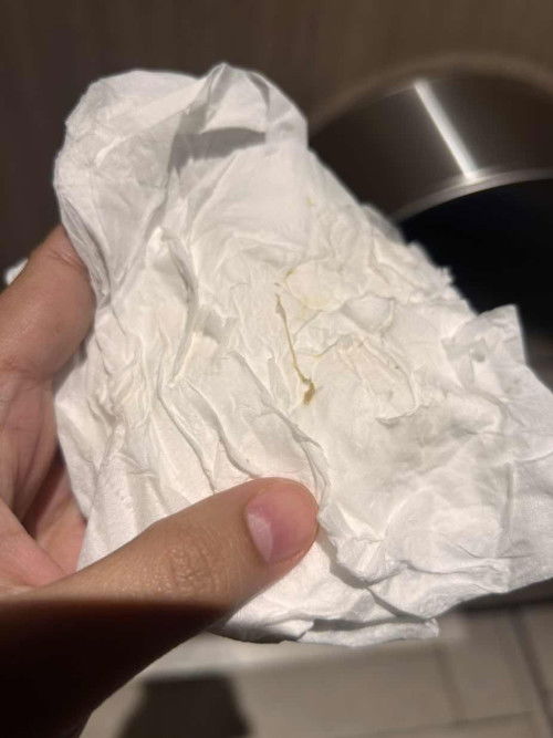 Help to identify my mucus