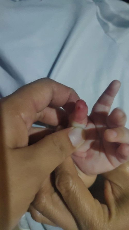 Ano po kaya ito? at pano ito mawawala