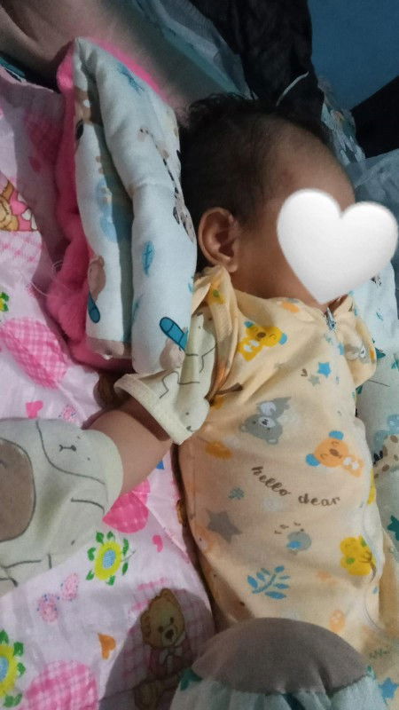 bayi sulit bernafas