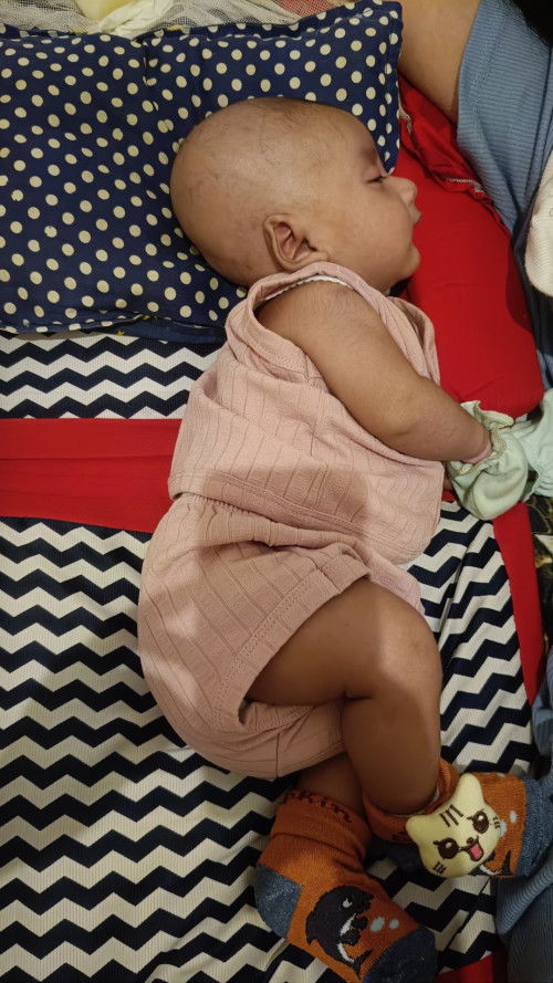 Kepala bayi peang