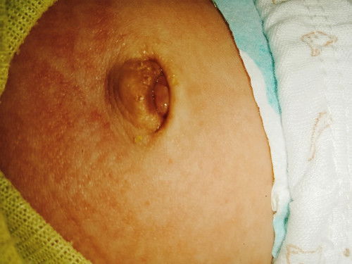 pusar bayi 22 hari basah