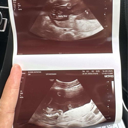 Scan gender