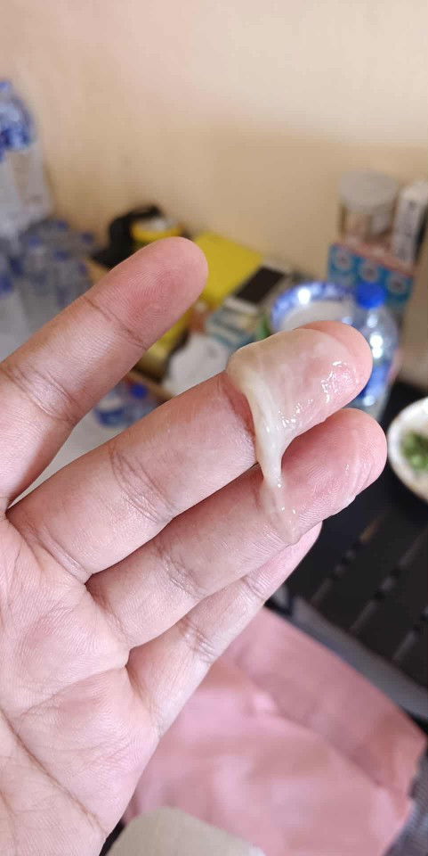 แบบนี้เรียกมูกใสไหมค่ะ อยากสอบถามผู้รู้ค่ะ