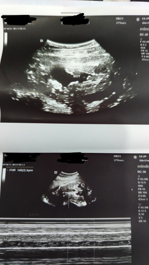 Hello po, sure po bang baby boy 👶? Thank you ☺️