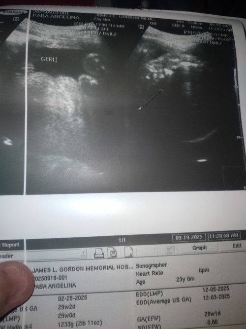 Pwede ba magkamali ang ultrasound?

At ano po ang posisyon ng baby ko? Bakit po nasabi ba baby girl?